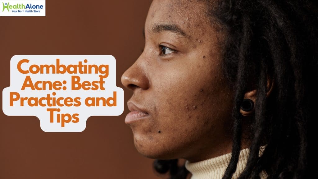 Combating Acne Best Practices Tips
