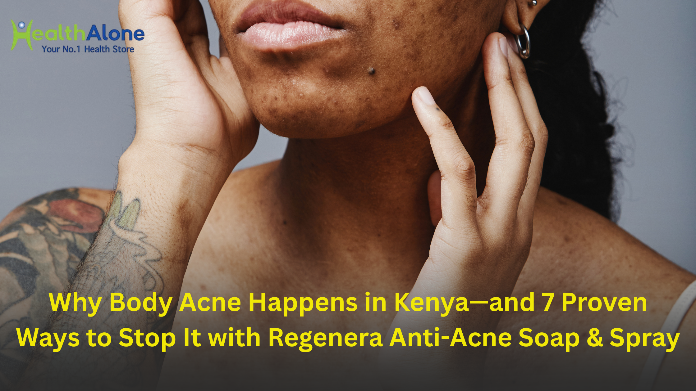 Body acne in kenya